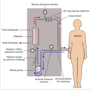 schema_dialisi